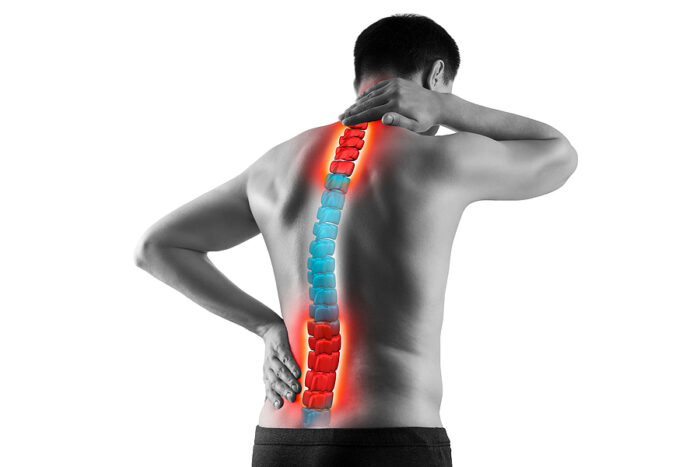 Signs of Scoliosis and How a Scoliosis Chiropractor Can Help